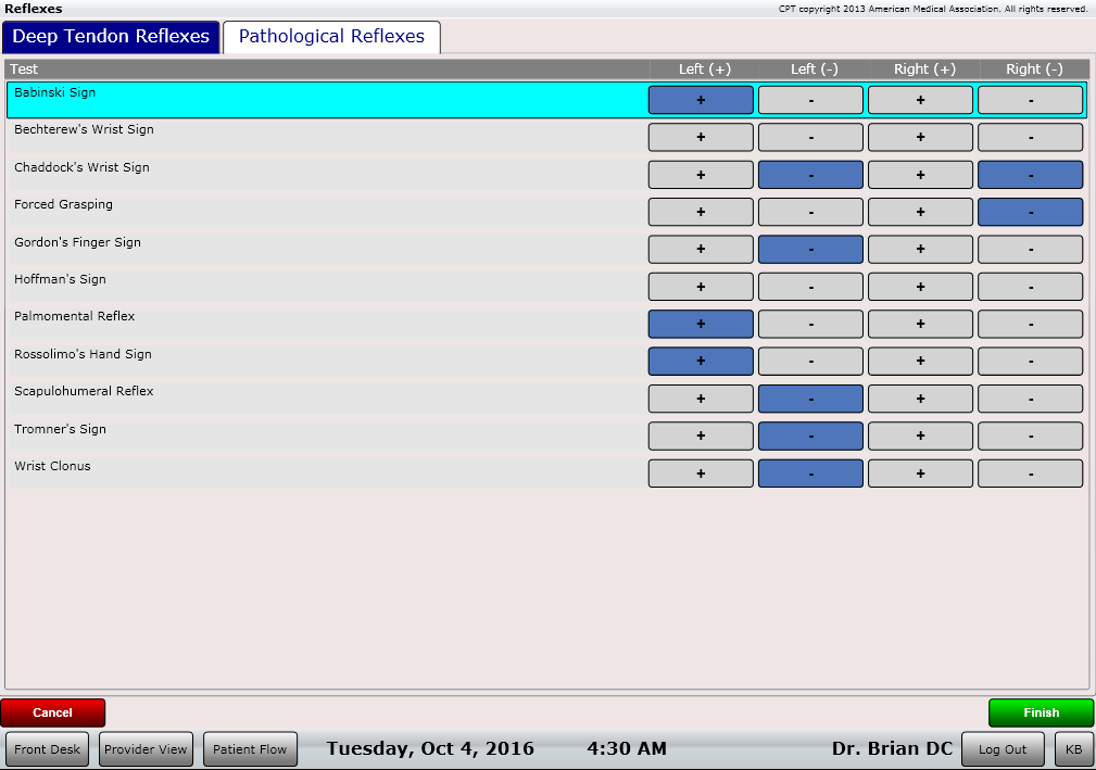 ChiroSpring Pathological Reflexes